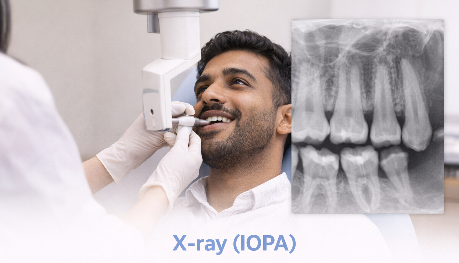 Treatment room prepared for intraoral periapical x-rays